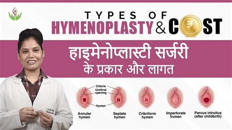 Is hymenoplasty temporary?