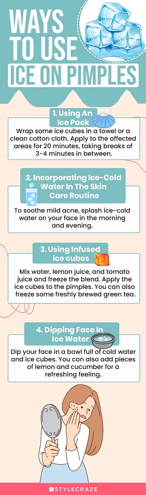 Is ice OK for pimples?