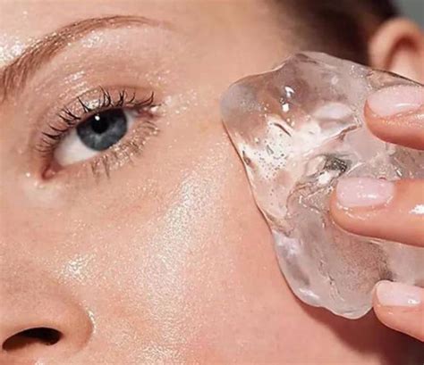 Is ice good for dark circles?