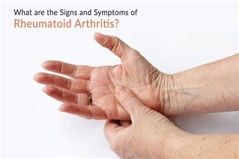 Is it OK not to treat rheumatoid arthritis?