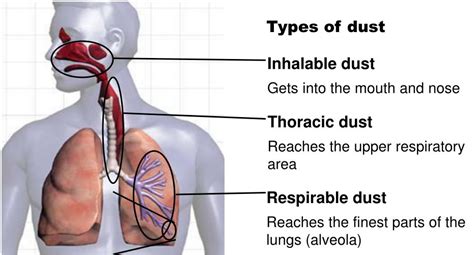 Is it OK to breathe in wood dust?