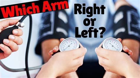 Is it OK to check BP on right arm?