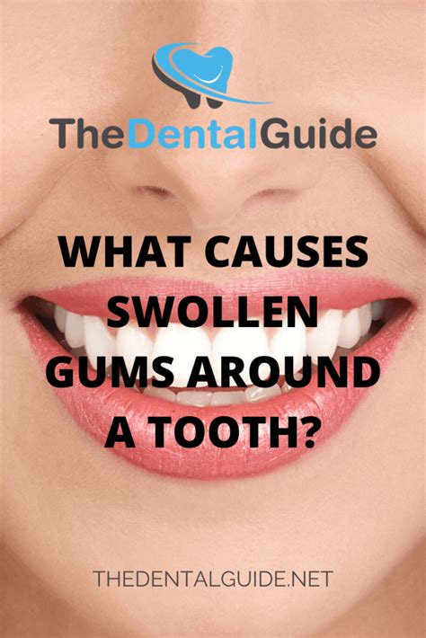 Is it OK to eat on your gums?