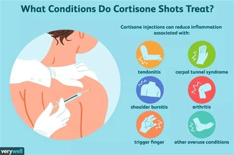 Is it OK to exercise after a cortisone shot?