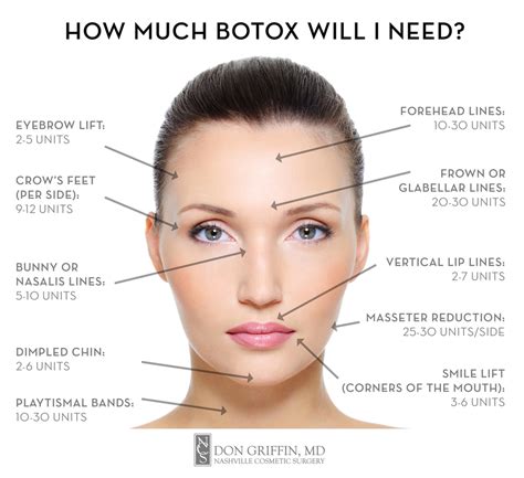 Is it OK to get Botox every 4 months?