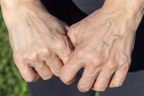 Is it OK to have veiny hands?