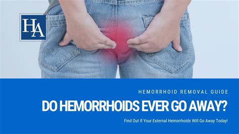 Is it OK to ignore hemorrhoids?
