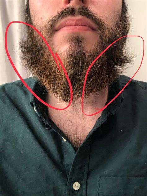 Is it OK to not have beard at 18?