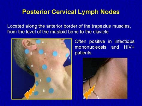 Is it OK to press lymph nodes?