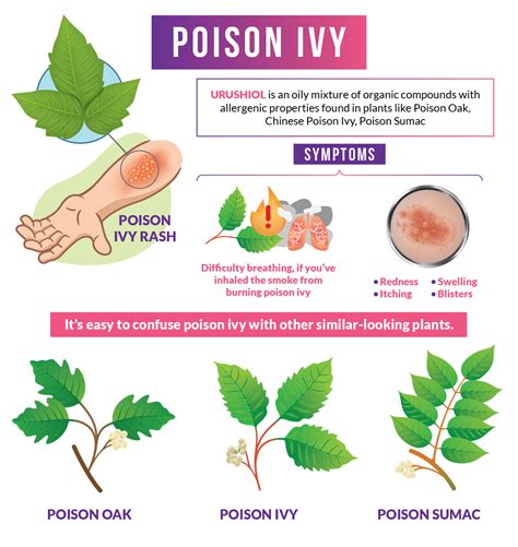 Is it OK to put hot water on poison ivy?