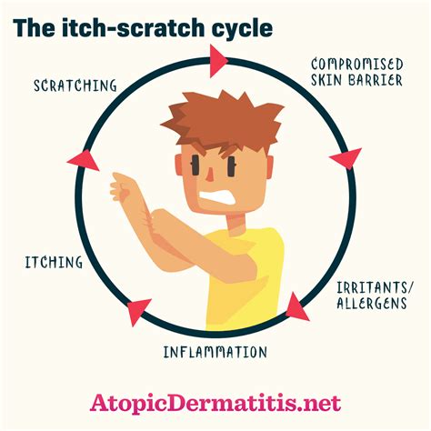 Is it OK to scratch an itch?