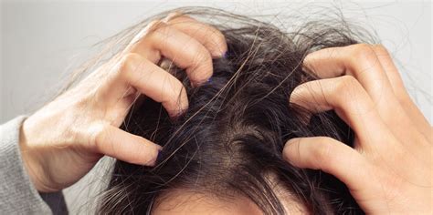 Is it OK to scratch itchy scalp?