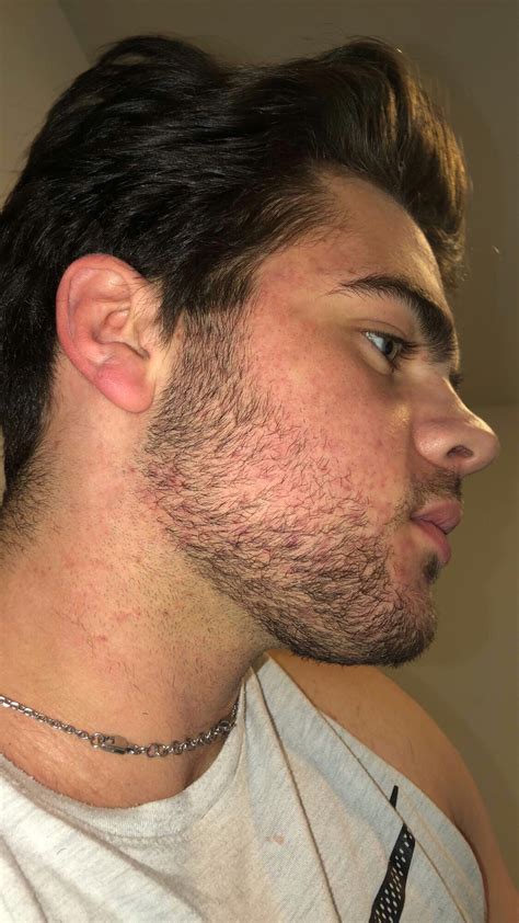 Is it OK to shave beard at 16?