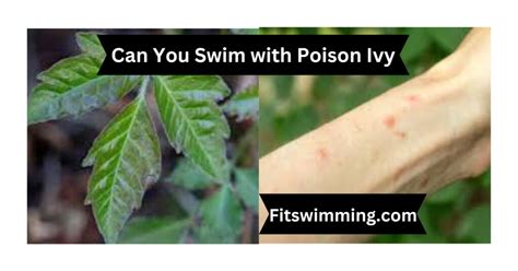 Is it OK to swim with poison ivy?