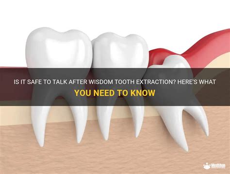 Is it OK to talk after tooth extraction?