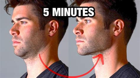 Is it actually possible to improve your jawline?