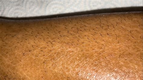 Is it bad to pluck leg hair?