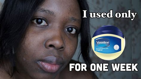 Is it bad to put on Vaseline everyday?