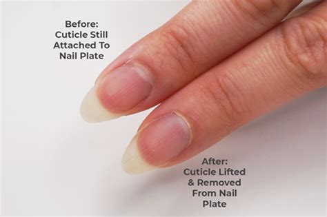 Is it bad to remove cuticles?