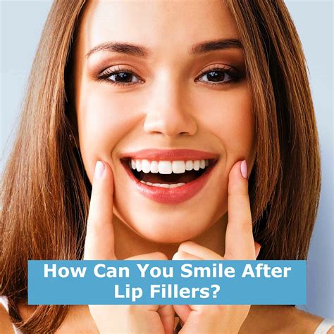 Is it bad to smile after lip fillers?