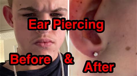 Is it bad to twist your ear piercing?
