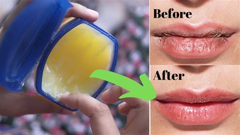 Is it better to put Vaseline on wet or dry lips?