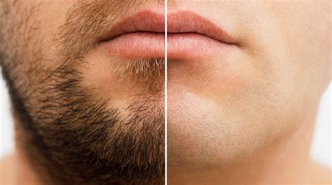 Is it good or bad to shave your face?