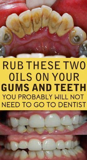 Is it good to rub your gums?