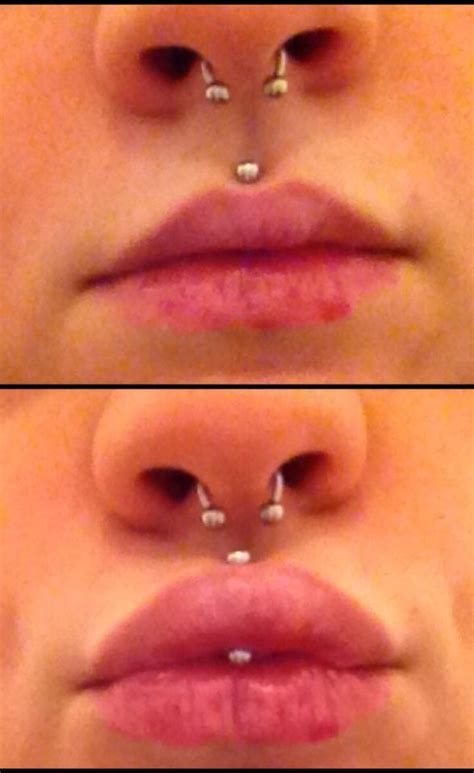 Is it hard to kiss with a medusa piercing?