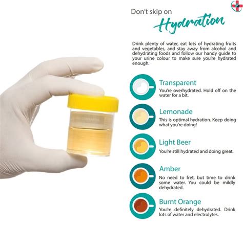 Is it normal for urine to be odorless?