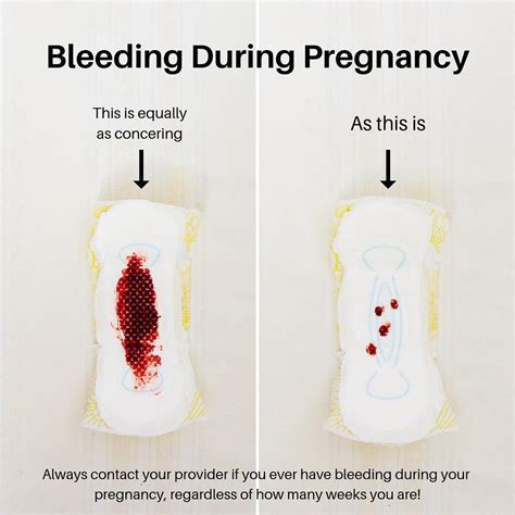 Is it normal to bleed after 13 months of no period?