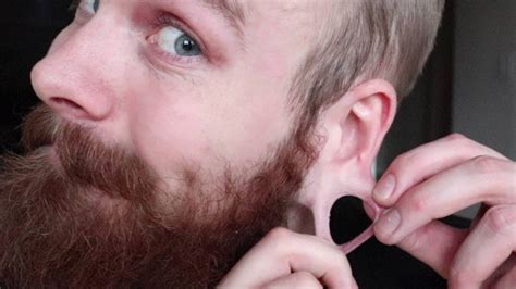 Is it normal to bleed when stretching your ears?