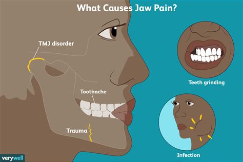 Is it normal to feel a ball in your jaw?