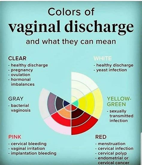 Is it normal to have a yellow discharge?