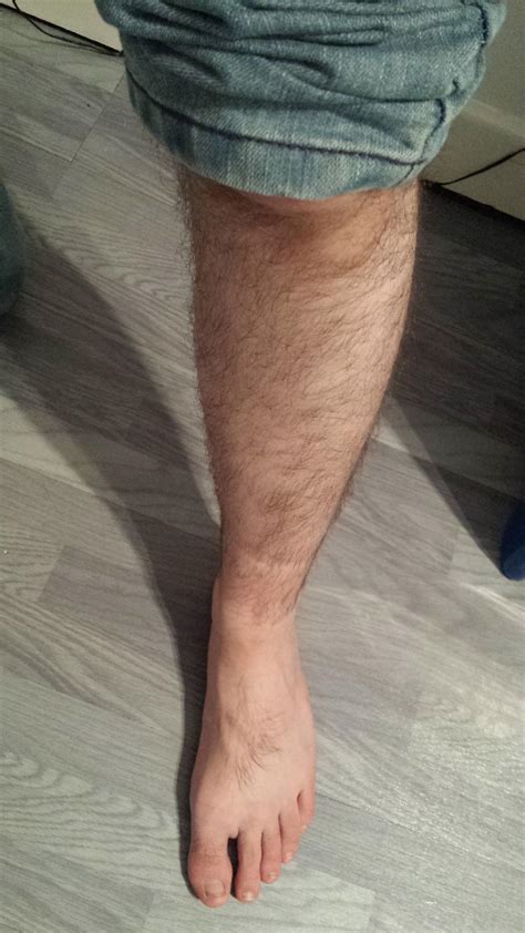 Is it normal to have hairy legs at 15?