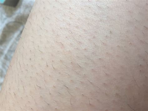 Is it normal to have little hairs left after waxing?