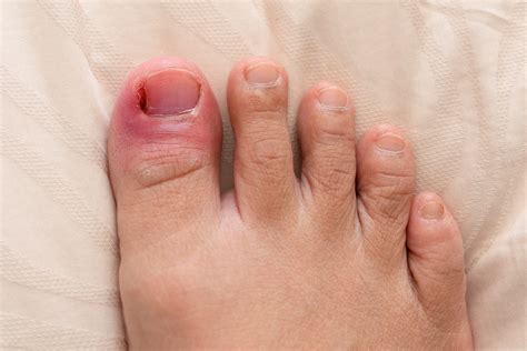 Is it normal to have pain after pedicure?