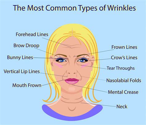 Is it normal to have wrinkles at 26?