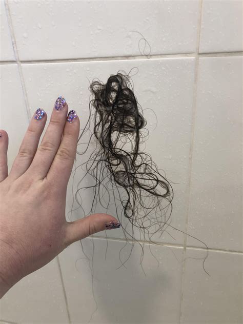 Is it normal to lose hair when brushing after shower?