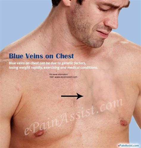 Is it normal to see chest veins?