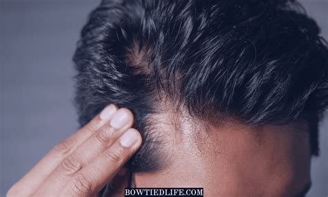 Is it normal to see scalp at front of hair?