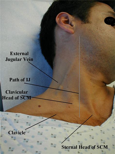 Is it normal to see veins in your neck?