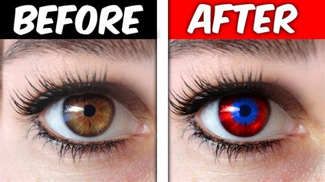 Is it possible to dye your eyes?