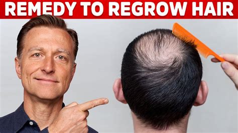 Is it possible to regrow frontal hairline?