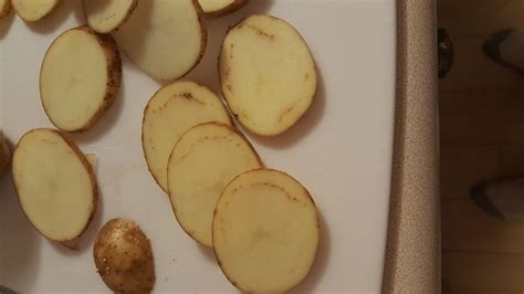 Is it safe to eat potatoes with brown spots inside?