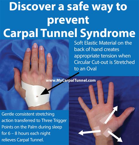Is it safe to ignore carpal tunnel?