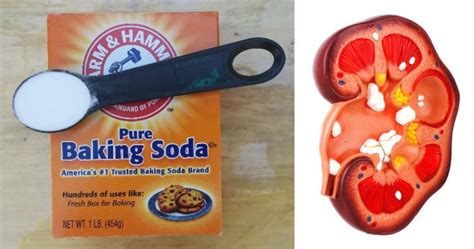Is it safe to take a teaspoon of baking soda daily?