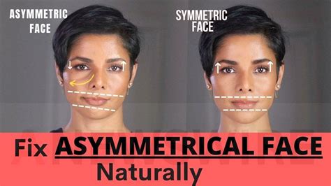 Is it true that sleeping on one side cause facial asymmetry?