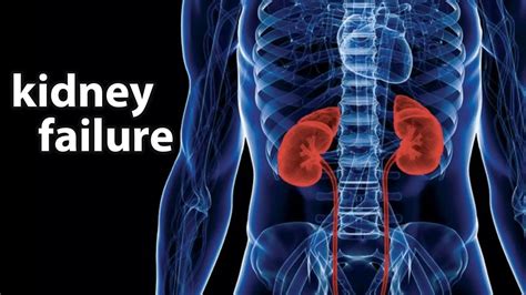 Is kidney failure a slow death?