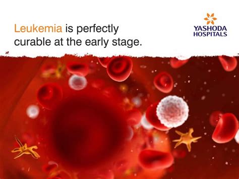 Is leukemia curable if caught early?